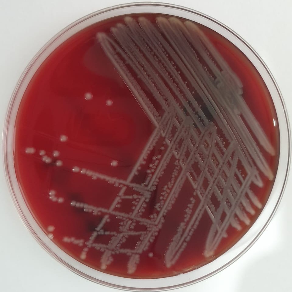 Bacteriología y micología